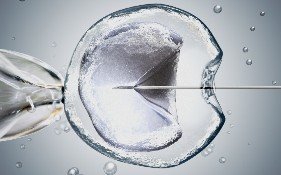 ICSI - Intracytoplasmic Sperm Injection