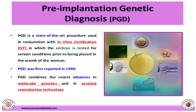 PGD