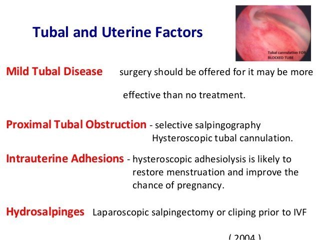 TUBAL FACTOR INFERTILITY TREATMENT